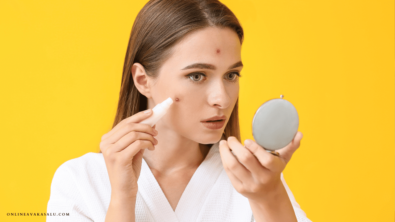 Best Remedy for Pimples - ముఖం పై మొటిమలు ఉన్నాయా