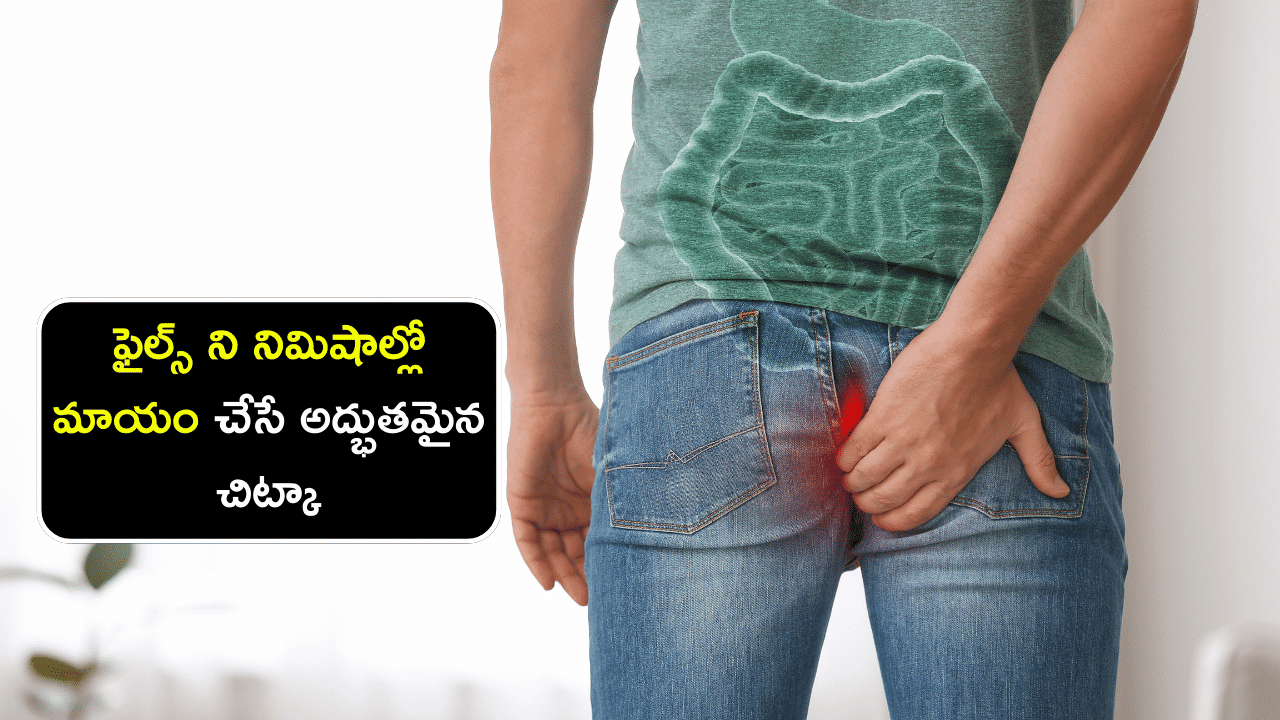 Piles Home Remedies - ఫైల్స్ ని నిమిషాల్లో మాయం చేసే అద్భుతమైన చిట్కా