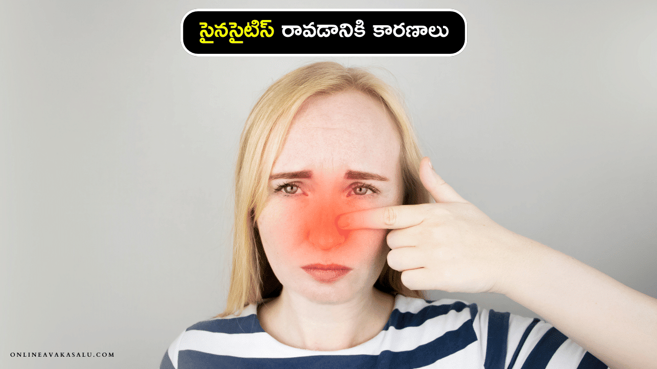 Sinusitis causes symptomos : సైనసైటిస్ రావడానికి కారణాలు