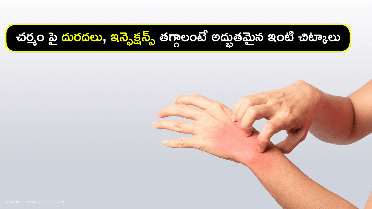 skin allergy : చర్మం పై దురదలు, ఇన్ఫెక్షన్స్ తగ్గాలంటే అద్భుతమైన ఇంటి చిట్కాలు