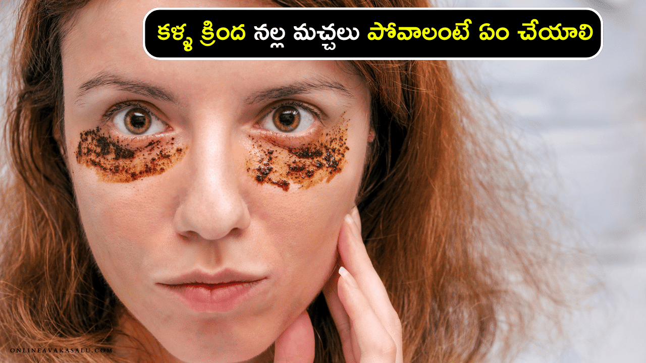 Clear Dark Circles in Minutes : కళ్ళ క్రింద నల్ల మచ్చలు పోవాలంటే ఏం చేయాలి