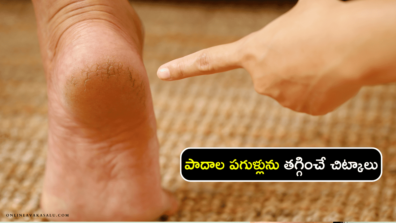 Cracked Foot : పాదాల పగుళ్లును తగ్గించే చిట్కాలు