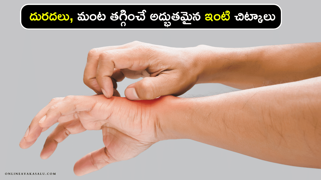 Itching : దురదలు, మంట తగ్గించే అద్భుతమైన ఇంటి చిట్కాలు