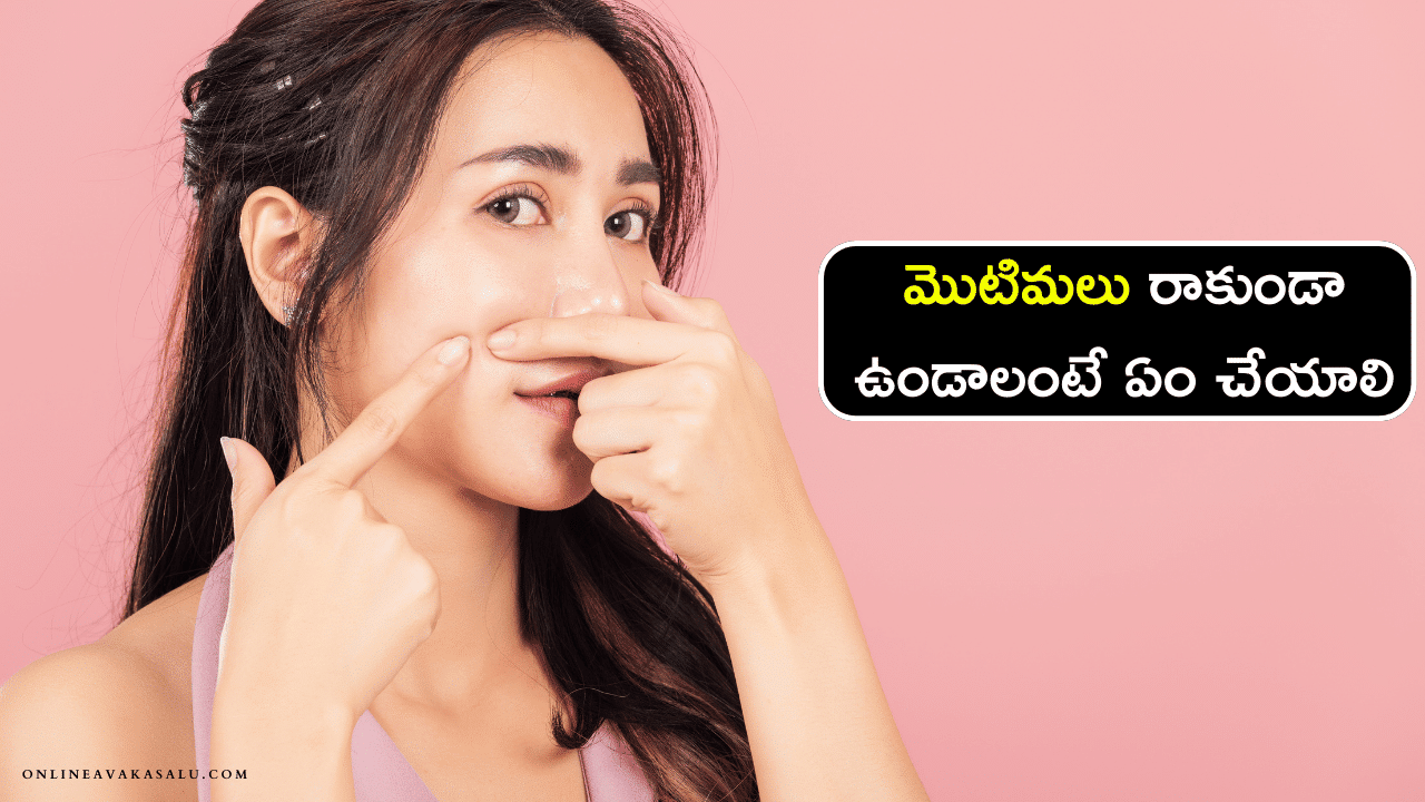 Motimalu Thaggalante : మొటిమలు రాకుండా ఉండాలంటే ఏం చేయాలి