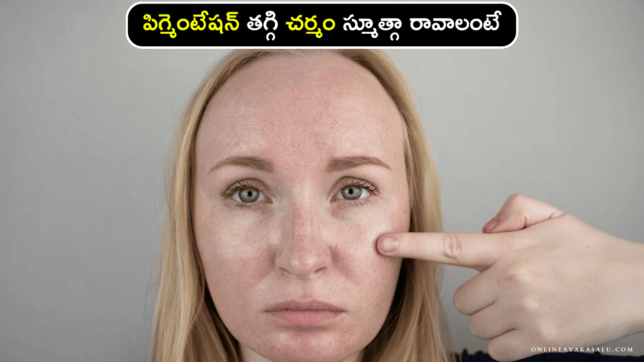 Skin Pigmentation : పిగ్మెంటేషన్ తగ్గి చర్మం స్మూత్గా రావాలంటే