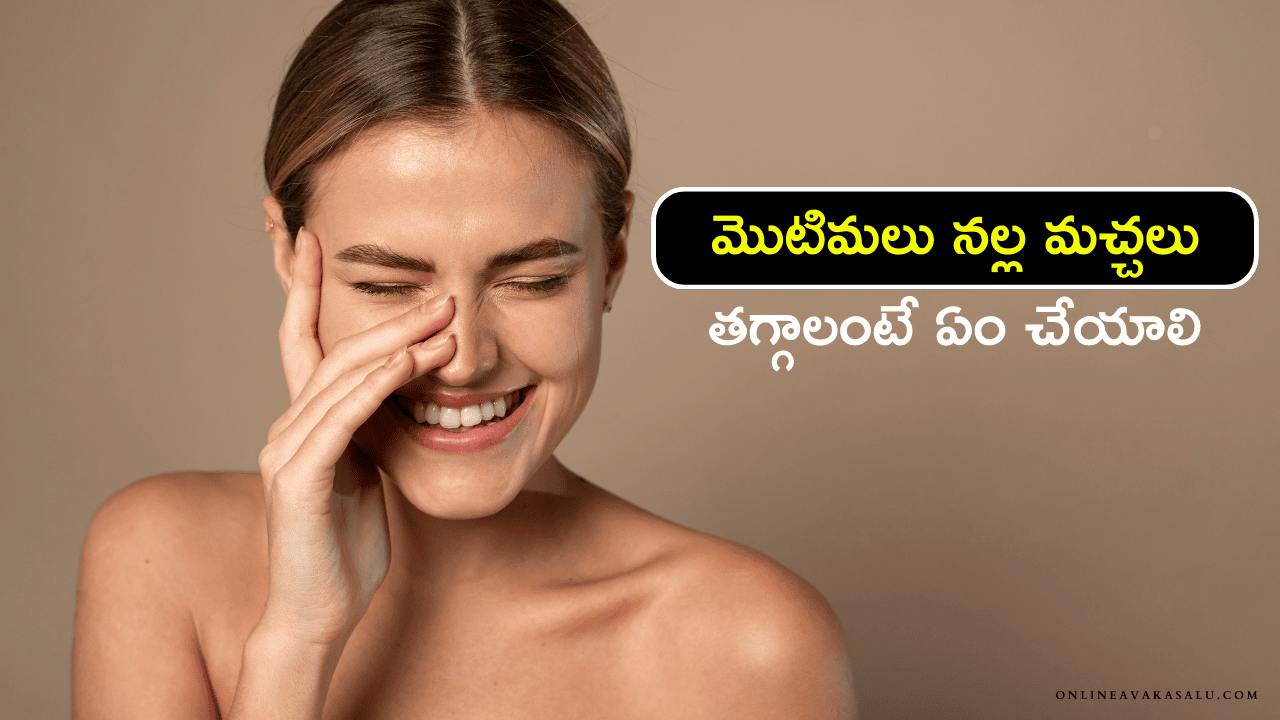 Winter Skin Care : మొటిమలు నల్ల మచ్చలు తగ్గాలంటే ఏం చేయాలి